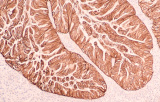 Chromogens for IHC