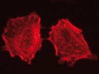 Fluorescent Markers for Actin Visualization