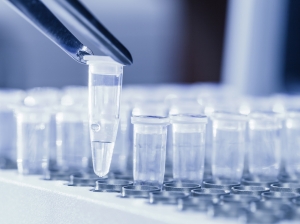 RT-PCR Protocol