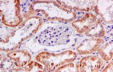 Immunohistology