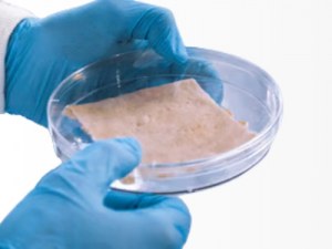 Access to Human Skin Tissue for Translational Research