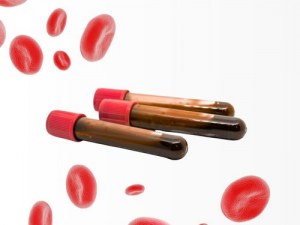 From Whole Blood to PBMCs: Your Complete Blood Derived Sample Portfolio
