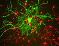 Immunostaining of mixed cultured rat neurons stained with anti-NFL antibody (Cat. 1452-NFL, green, 1:100) and anti-alpha internexin.