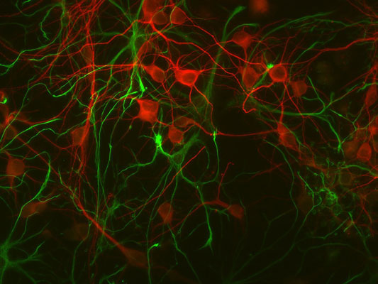 Immunolabeling of mouse cortical cultures labeled with Anti-GFAP (Cat. 620-GFAP, 1:1000, green) and anti-MAP2 (1100-MAP2, 1:1000, red).