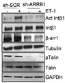 Representative WB of whole cell lysates from sh-SCR and sh-ARRB1 HOFs stimulated or not with ET-1 (5 min) and probed with antibodies to active or total Intβ1, b-arr1, pTalin (Cat. TP4171) and Talin. Image from publication CC-BY-4.0. PMID: 38777849