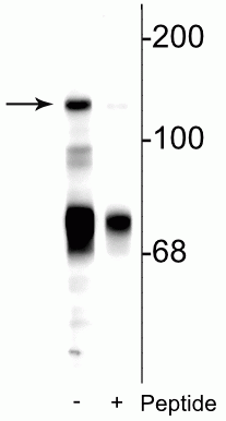 Western blot of rat cerebellar lysate showing specific immunolabeling of the ~140 kDa NR2C subunit of the NMDA receptor phosphorylated at Ser1244 in the first lane (-). Phosphospecificity is shown in the second lane (+) where immunolabeling is blocked by preadsorption of the phosphopeptide used as the antigen, but not by the corresponding non-phosphopeptide (not shown). 