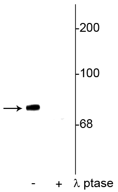 Western blot of rat cortical lysate showing specific immunolabeling of the ~78 kDa synapsin I phosphorylated at Ser549 in the first lane (-). Phosphospecificity is shown in the second lane (+) where the immunolabeling is completely eliminated by blot treatment with lambda phosphatase (λ-Ptase, 1200 units for 30 minutes). 