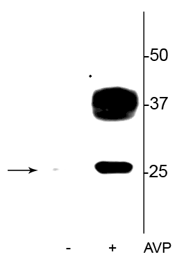 Western blot of rat kidney lysate showing specific immunolabeling of the ~29 kDa and 37 kDa glycosylated form of the AQP2 protein phosphorylated at Ser269 in the vasopressin (AVP) treated lane (+), but not in the control lane (-). 