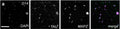 Day 14 (D14) RGC-iNs stained with a DAPI, TAU (Cat. 1998-TAU, 1:1000), and MAP2. Image from publication CC-BY-4.0. PMID: 37773257