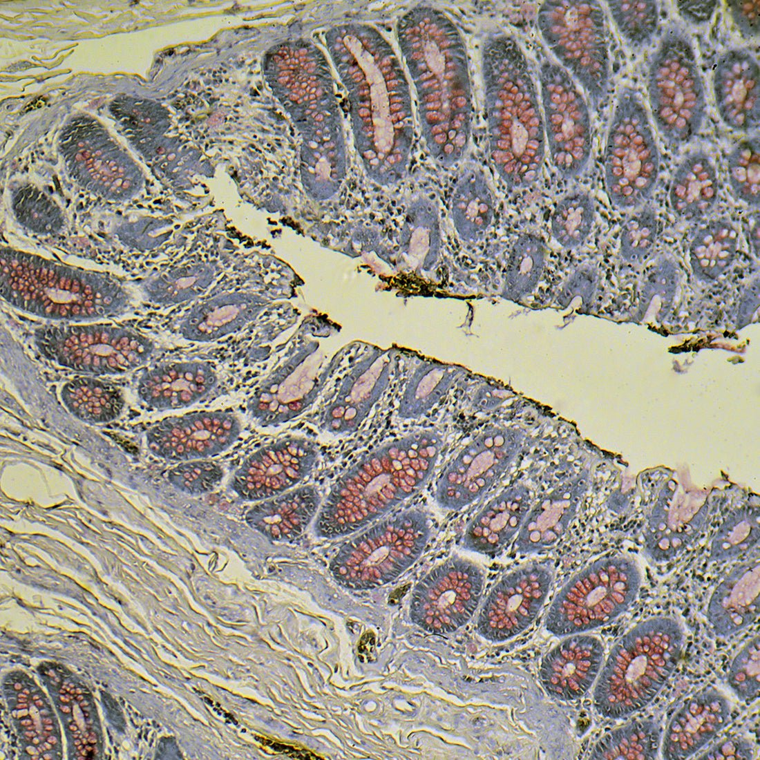 Mucicarmine Stain Kit - Polysciences