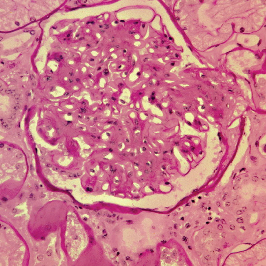 Periodic Acid Schiff's (PAS) Stain Kit - Polysciences