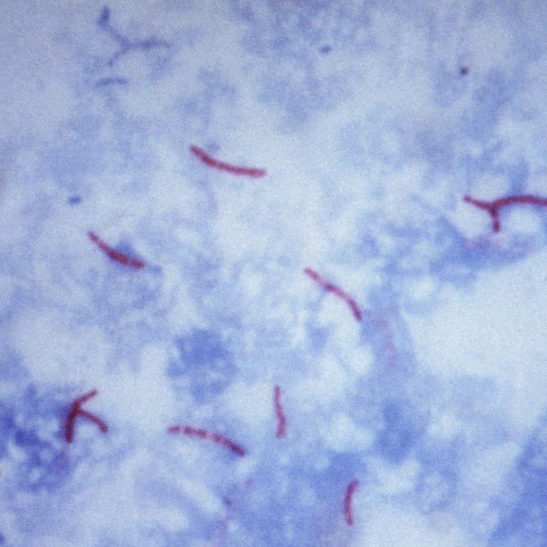 AFB Ziehl - Neelsen Kit (Hot Method) - Polysciences