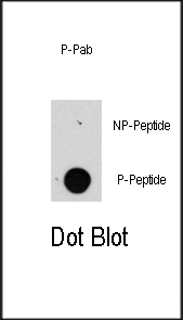 DB - Phospho-Raptor(S863) Antibody AP3495a