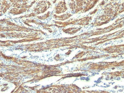 IHC - Caldesmon, HMW (h-Caldesmon) (Smooth Muscle Marker) Antibody - With BSA and Azide AH12566-20