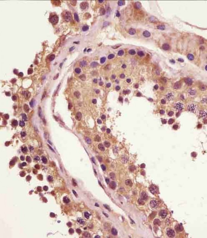 IHC-P - BRAF V600E Antibody(C-Term) AP22342b