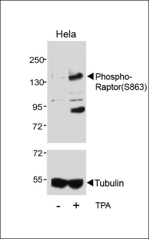 WB - Phospho-Raptor(S863) Antibody AP3495a