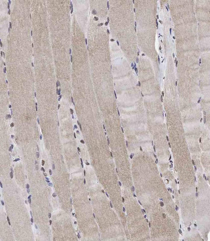 IHC-P - Phospho-Raptor(S863) Antibody AP3495a