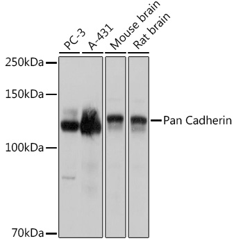 Pan Cadherin Polyclonal Antibody - 1