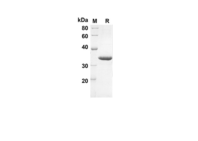 Recombinant Mouse IL16 Protein(Trx Tag) - 1