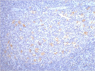 CD68 Monoclonal Antibody - 2