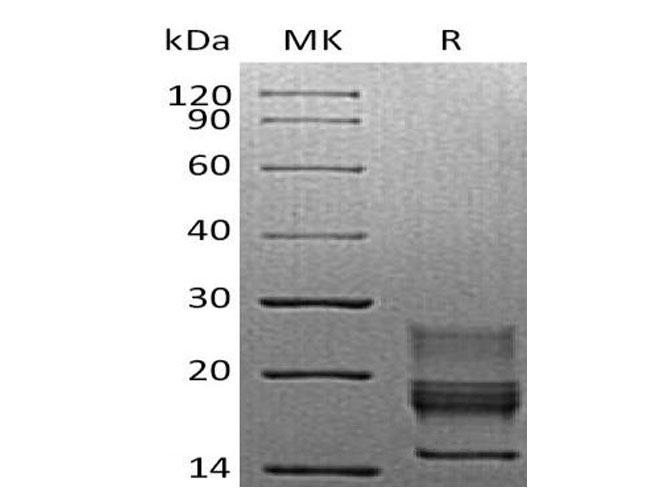 Recombinant Mouse Interferon γ/IFNG Protein (His Tag) - 1