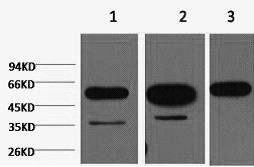 beta Tubulin Monoclonal Antibody - 1