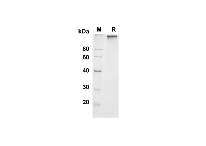 Recombinant Mouse Leptin R Protein(Fc Tag) - 1