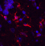 GFAP Monoclonal Antibody - 3