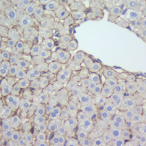 N-cadherin Polyclonal Antibody - small - 4