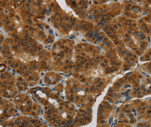 MRE11 Polyclonal Antibody - 1