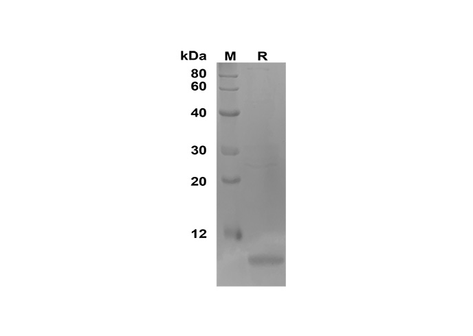 Recombinant Human GRO Protein - 1