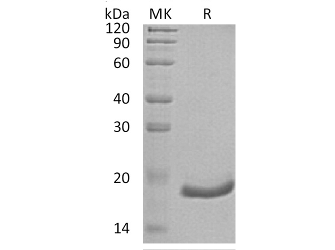 Recombinant Human Interferon α-6/IFNA6 Protein (His Tag) - 1