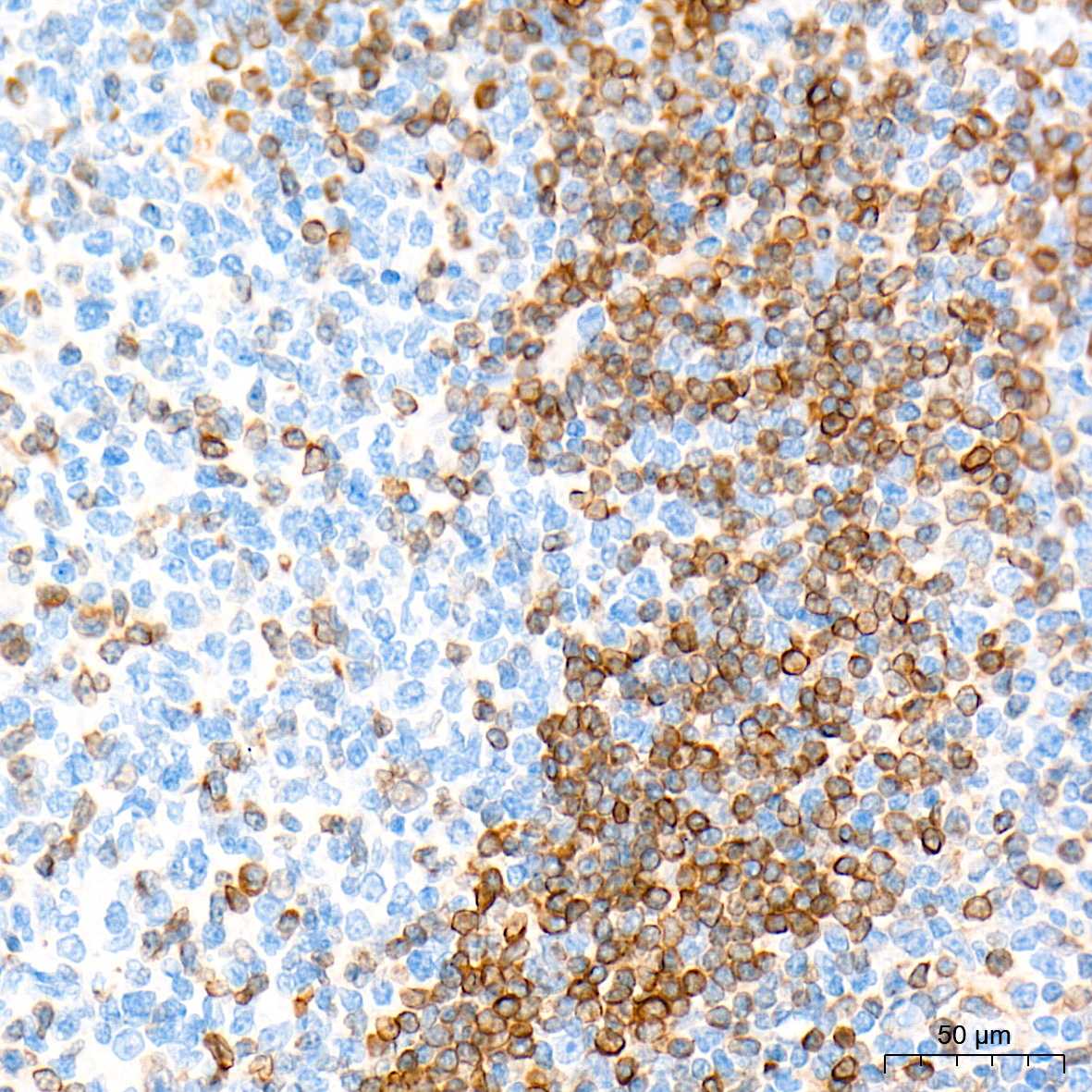 Bcl-2 Polyclonal Antibody - small - 4