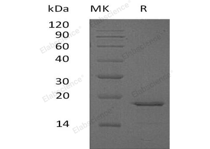 Recombinant Human Glucagon/GCG Protein (His Tag) - 1