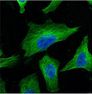 beta Tubulin Monoclonal Antibody - 2