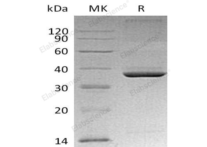 Recombinant Mouse Apolipoprotein E/ApoE Protein (His Tag) - 1