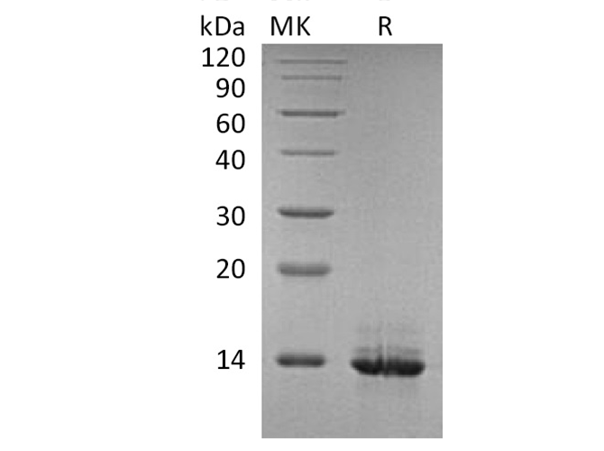 Recombinant Human HMGB1 Protein - 1