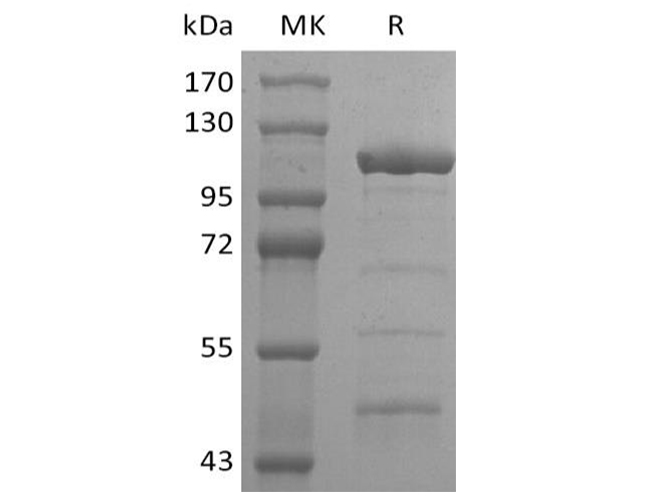 Recombinant SARS-CoV-2 Helicase Protein (His Tag) - 1