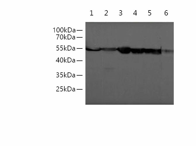 beta Tubulin Monoclonal Antibody - 1