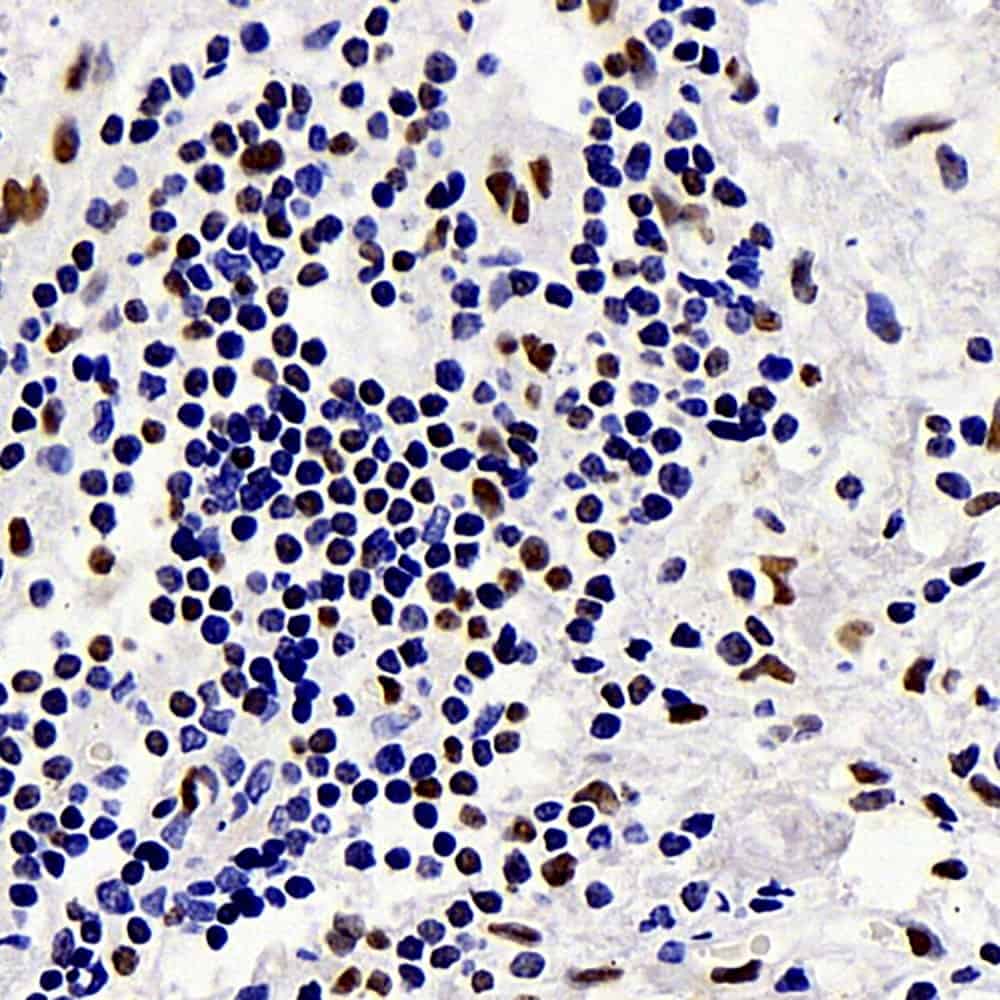 c-Fos Monoclonal Antibody - 2