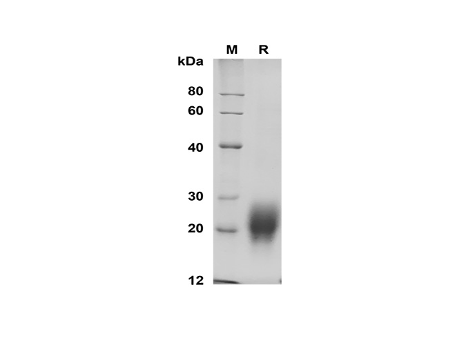 Recombinant Human FSH-b Protein (His Tag) - 1