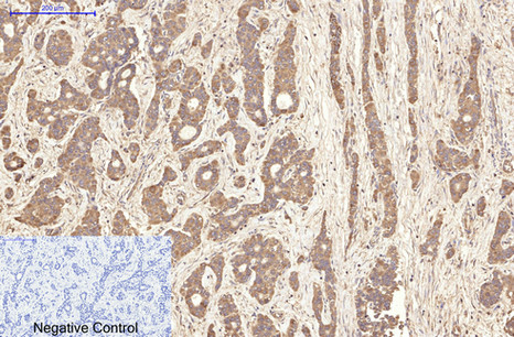 AQP4 Monoclonal Antibody - 2