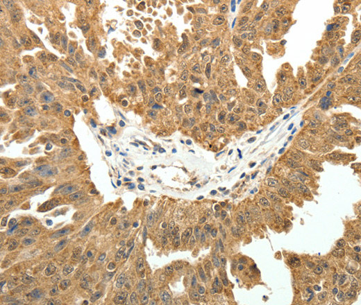 PTCH1 Polyclonal Antibody - 2