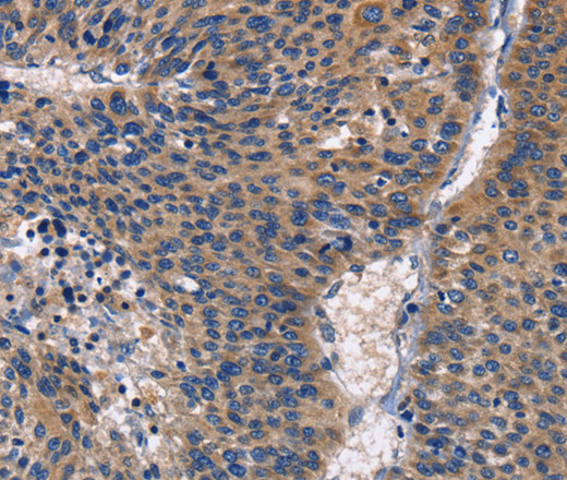 PKC delta Polyclonal Antibody - 2