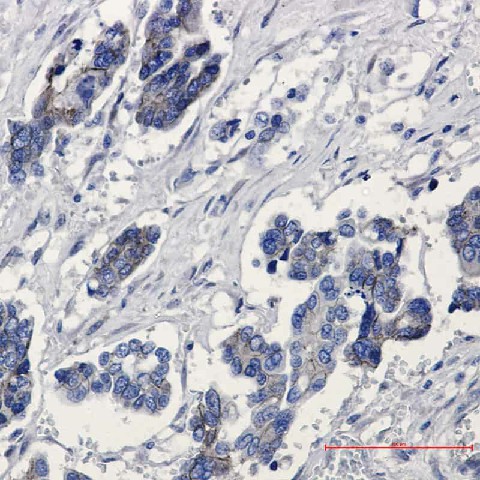 Recombinant beta Catenin Monoclonal Antibody - 2