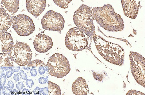 beta Tubulin Monoclonal Antibody - 2