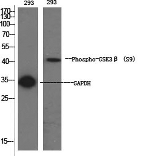 Phospho-GSK3 beta (Ser9) Polyclonal Antibody - small - 1