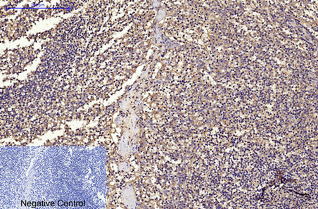 CD68 Monoclonal Antibody - 1