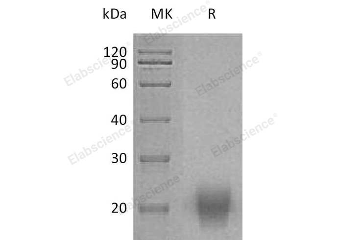Recombinant Human FSH Protein (Flag & His Tag) - 1