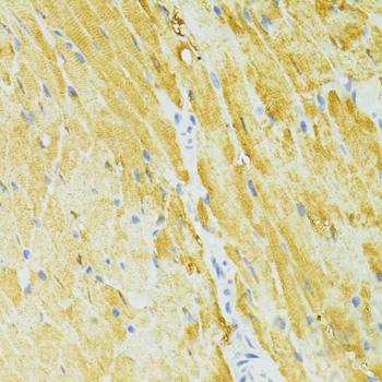 SIRT2 Polyclonal Antibody - 3